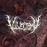 Vulvectomy